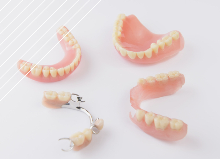 clínica dental Protesis dentales tratamientos