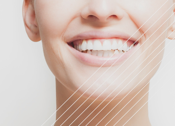 clínica dental tratamientos ortodoncia prevención