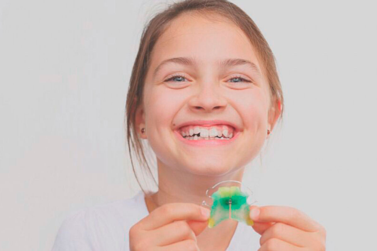 ¿Qué es el Apiñamiento Dental?