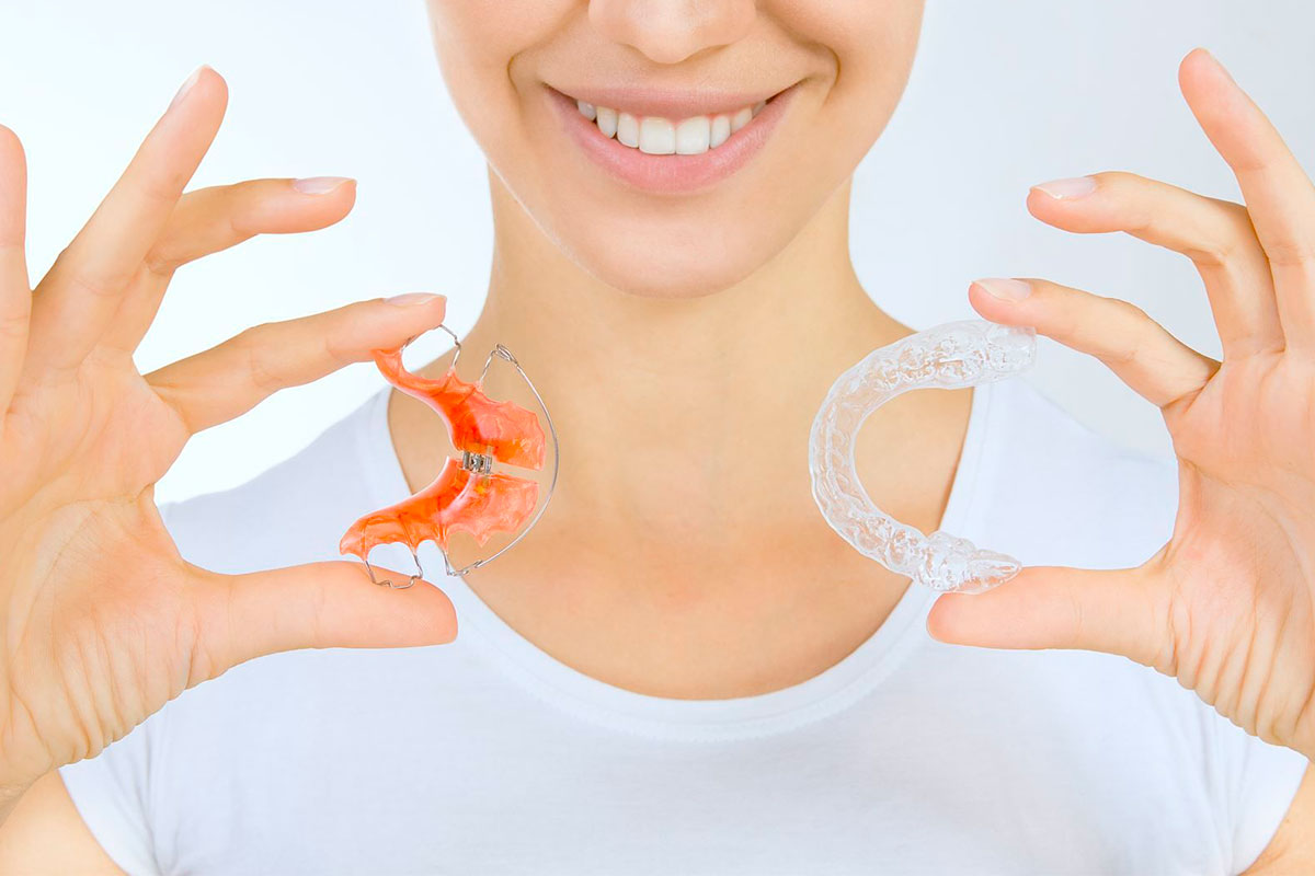 ¿Por qué usar los Retenedores tras un tratamiento de ortodoncia?